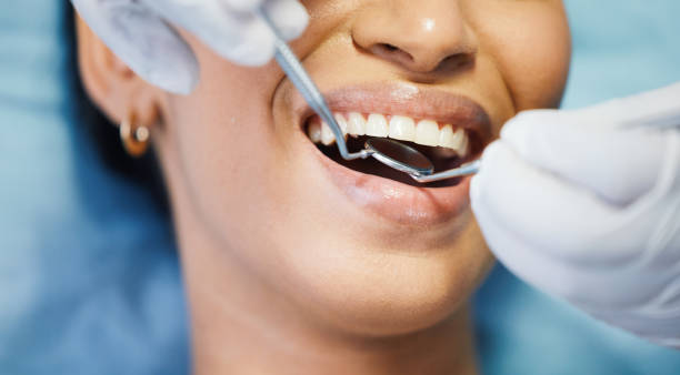 Best Emergency Root Canal Treatment in Laurel, MS